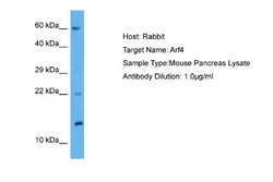 ARF4 Rabbit anti-Mouse, Polyclonal, Novus Biologicals 0.1 mL | Buy Online | Novus Biologicals | Fisher Scientific